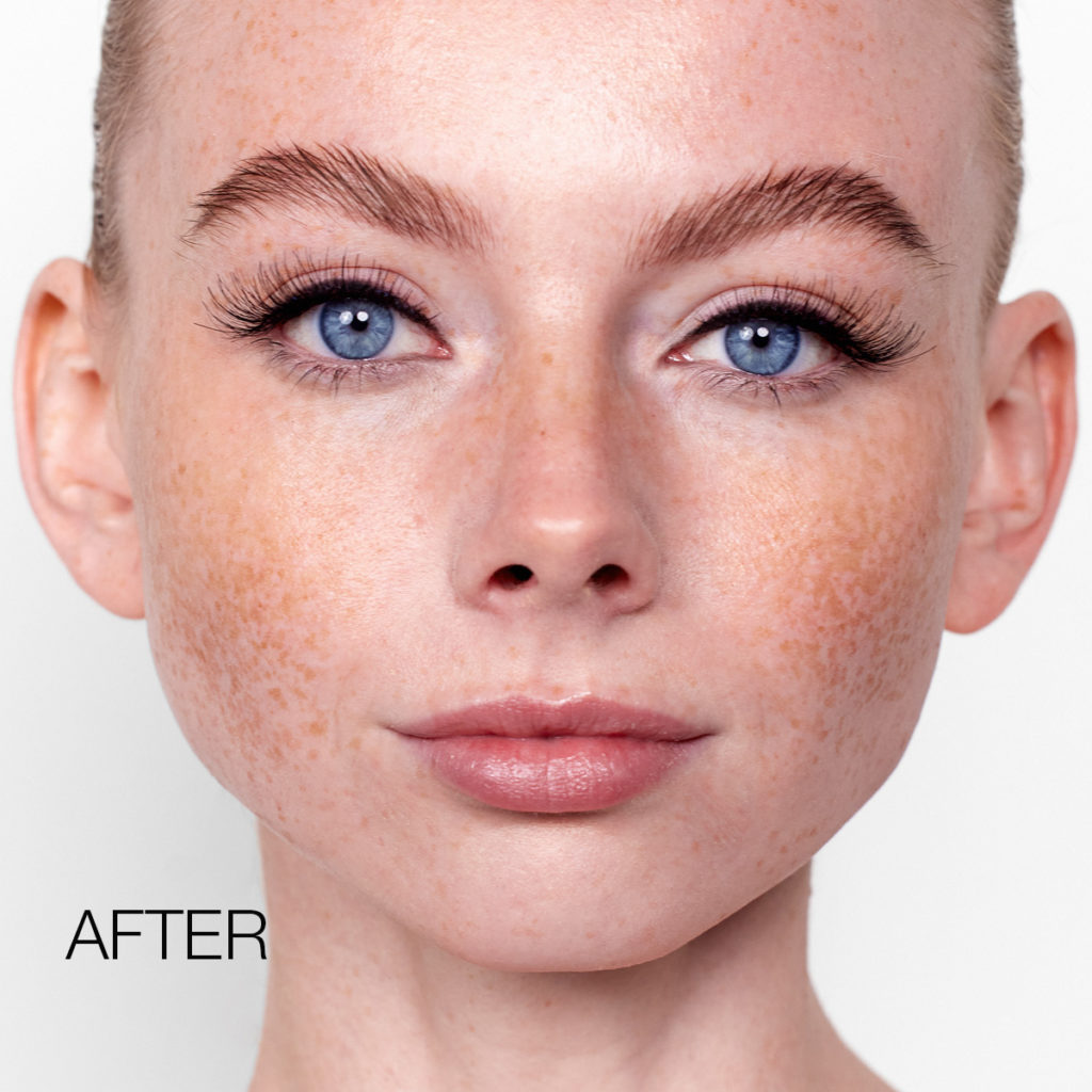 Depend Cosmetic